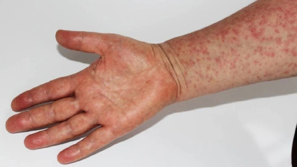 f960x540-137931_212006_5050