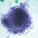 virus-del-sarampion-102145