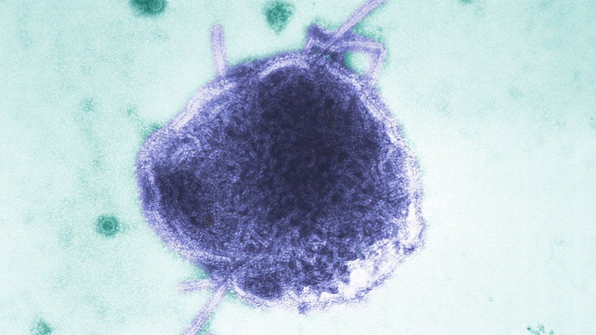 virus-del-sarampion-102145