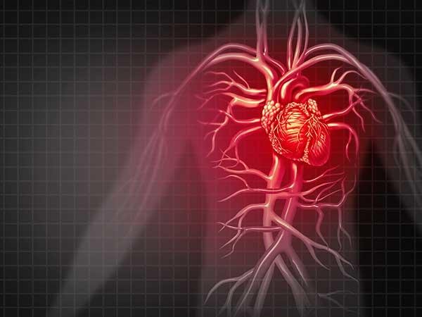 heart-attack-illustration-article
