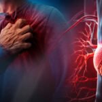 infarto-o-paro-cardiaco